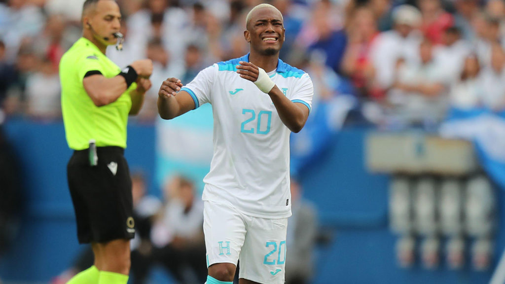 Palpite: Bermudas x Honduras – Eliminatórias da Copa – 09/06/2024