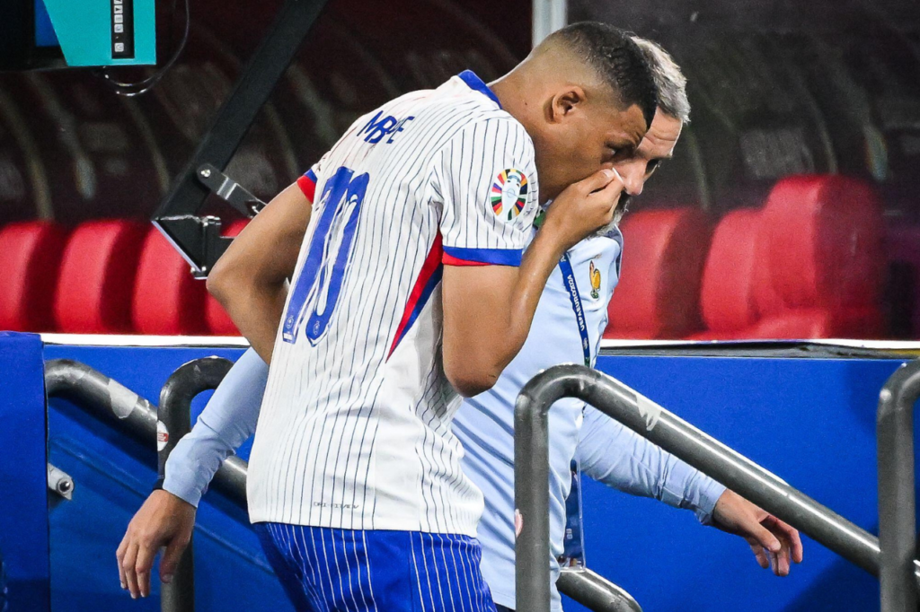 Mbappé-França-lesão-jogo-alamy2XCM111 Kylian Mbappé deixa o campo com nariz sangrando em jogo da seleção francesa