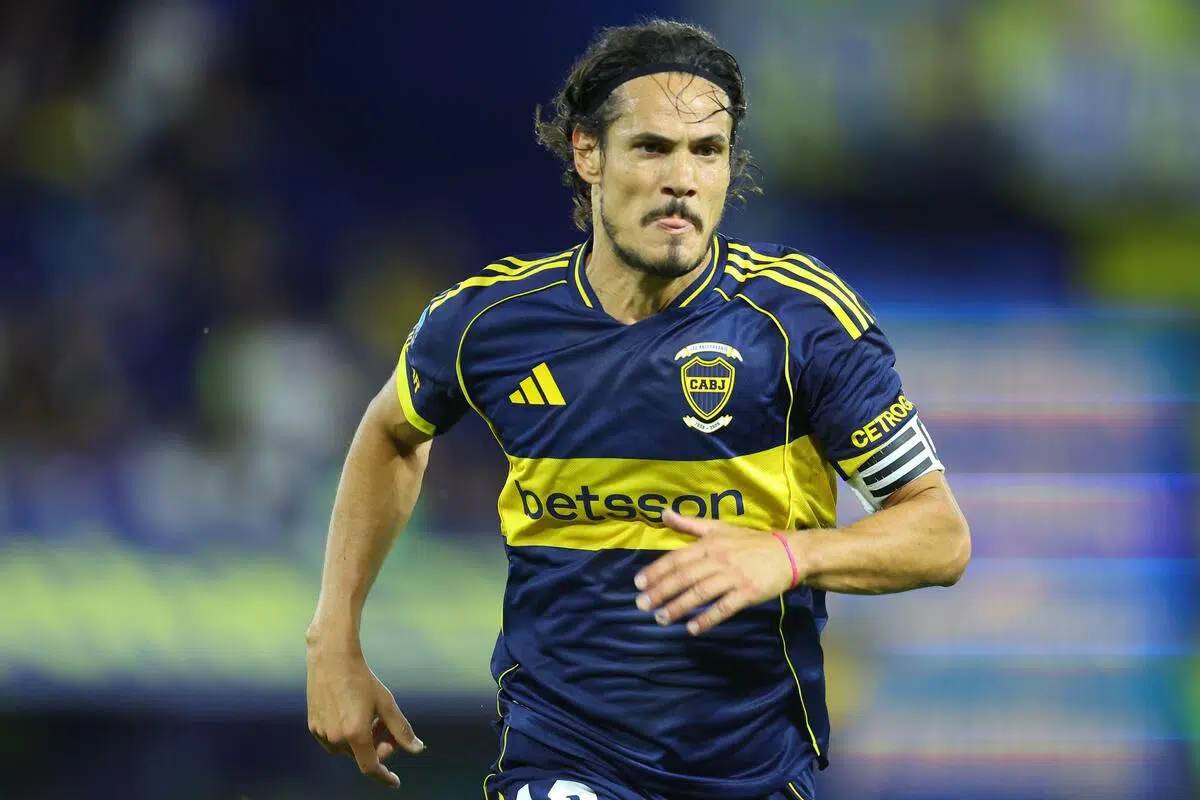 Palpite Boca Juniors Palpite Boca Juniors x Gimnasia Mendoza – Campeonato Argentino – 28/02/2026